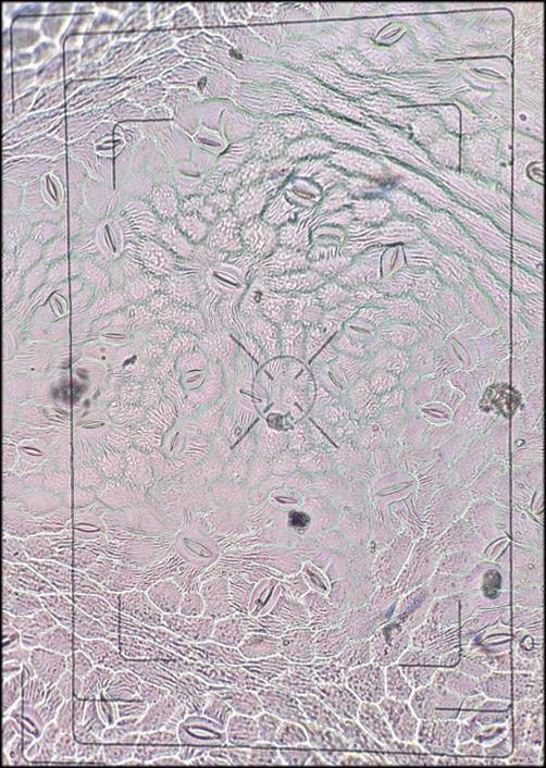 2015: 3 (1): 35 39 110R 41B ġekil 3. 110R ve 41B anacı üzerine aģılı Buca Razakısı üzüm çeģidinde stomaların mikroskobik görünümü (10x40).
