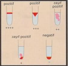 1. NUMUNENĠN HAZIRLANMASI INVITROLISS ile %0,8'lik eritrosit süspansiyonu hazırlanır. (0,5 ml INVITROLISS "bir basım" + 20µL tam kan ya da 10 µl sediment) 2.