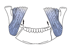 (a) (b) Şekil 2.1: Vertikal (a), Horizontal (b) uygun ve uygun olmayan kırık (12) Anatomik bölgelere göre sınıflandırılan mandibula kırıklarının oranları da farklılık göstermektedir.