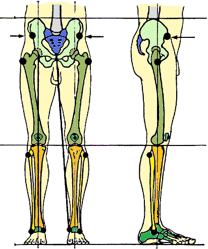 Soket yapısı ile ilgili kriterler: Bir protez soketinin fleksiyon konumu, bükülme kontraktürü (germe engeli) varsa ortaya çıkar. Fleksiyon açısı, bükülme kontraktürüne bağlıdır.