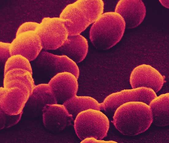 Yuvarlak Biçimdeki Bakteriler Yuvarlak Ģekilde görülen bakterilere genellikle, kok (kokkus) adı verilmektedir.