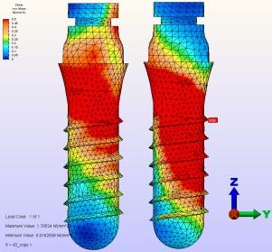 Mpa 95 A B C D E F ġekil 3.14. Protez modeli üzerine uygulanan 45 lik yükleme sonucu k: kaninler ve pm: 1. premolar bölgesindeki implantlarda oluģan Von Mises stres dağılımının incelenmesi.