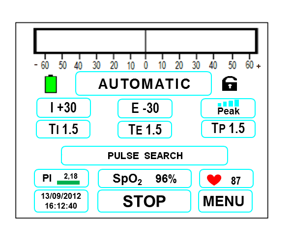 Nabız oksimetre bağlı olduğunda, PI, SpO2 ve nabız oranı parametreleri aşağıdaki şemada gösterildiği şekilde aktiftir. Masimo Oksimetreden Sistem Mesajları.