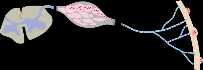 Varicella zoster, primer enfeksiyon sürecinde latent hale gelir Dorsal kök gangliyonu VZV duysal sinir boyunca dorsal kök gangliyonuna gider Omurilik Varisella döküntüsü Deri VZV dorsal kök