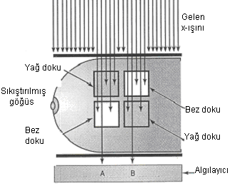 memeyi geçtiğinde doku örtüşmesi değişir ve bu normal ve normal olmayan dokuyu ayırmamıza yardım eder.