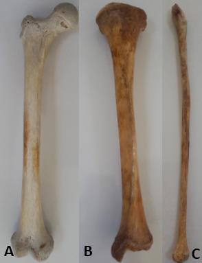 Alt Ekstremite Kemikleri Alt ekstremite kemikleri femoral (uyluk), crus (bacak) ve pedis (ayak) olmak üzere üç bölüme ayrılır. Femoral (uyluk) bölge: Kalça ile diz eklemi arasında yer alan bölgedir.