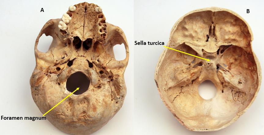 Bireysel Etkinlik Osteoloji Genel Bilgiler ve Vücut Kemikleri Os frontale (Alın kemiği) Os parietale (Çeper kemik) Os occipitale (Art kafa kemiği) Os temporale (Şakak kemiği) Os ethmoidale (Kalbur