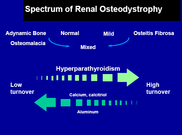 Renal Osteodistrofi Görünümü Adinamik Kemik Normal Hafif Osteitis Fibroza