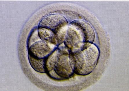 3. Gün Biyopsisi 8 hücreli embriyo (72 saat)