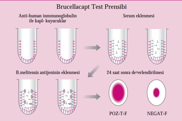 Yeni soyutlanan bakterilerde küçük bir kapsül bulunur.