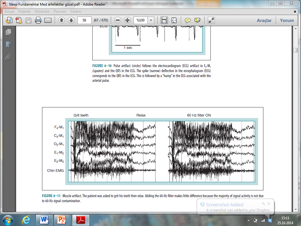 60 Hz filtresi kas artefaktını gidermez Genellikle hastanın uykuya