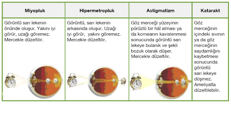 Oluşan görüntü buradaki görme almaçları tarafından algılanır. 4. Algılanan görüntü, görme sinirleri vasıtasıyla beyindeki görme merkezine iletilir.