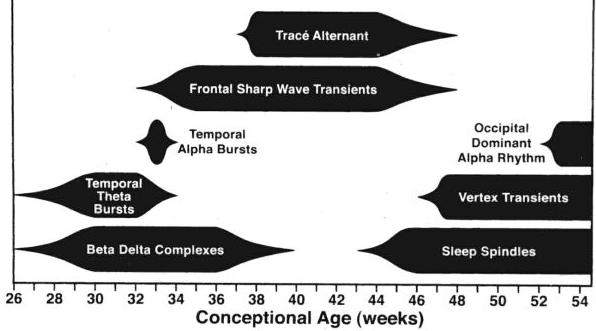 Sharp Transients: Geçici Keskin Dalga Aktiviteleri Patolojik Tanım: Multifokal