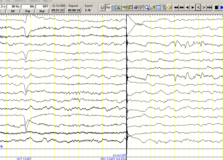 Uyanık N Uyku