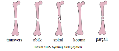 8.hangisi özellikli bölge yanıkları olup deneyimli bir yanık ünite/merkezinde bakımı gerekmeyen bölgelerdendir? a) Göz b) Kulak c) Yüz, el, ayak d) Kol e) Genital bölge 9.