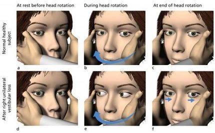 HEAD THRUST TEST