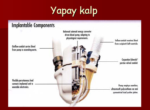 33 34 İç protezlerin (implant) ise birçok uygulama alanı vardır: ortopedi, kardiyovasküler, plastik cerrahi, üroloji, diş hekimliği, çene cerrahisi ve benzeri birçok