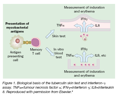 İnterferon gama salınım testi (İGST) İGST ve PPD latent TB infeksiyonu tanısı için geliştirilmiş indirekt testlerdir.