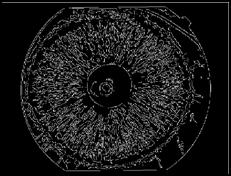 Morfolojik işlemler ile iris üzerinde şekiller daha da kesinleştirilmiştir. En son aşamada ise oluşan iris örüntüleri YSA ile eğitilerek sınıflandırma işlemi gerçekleştirilmiştir.