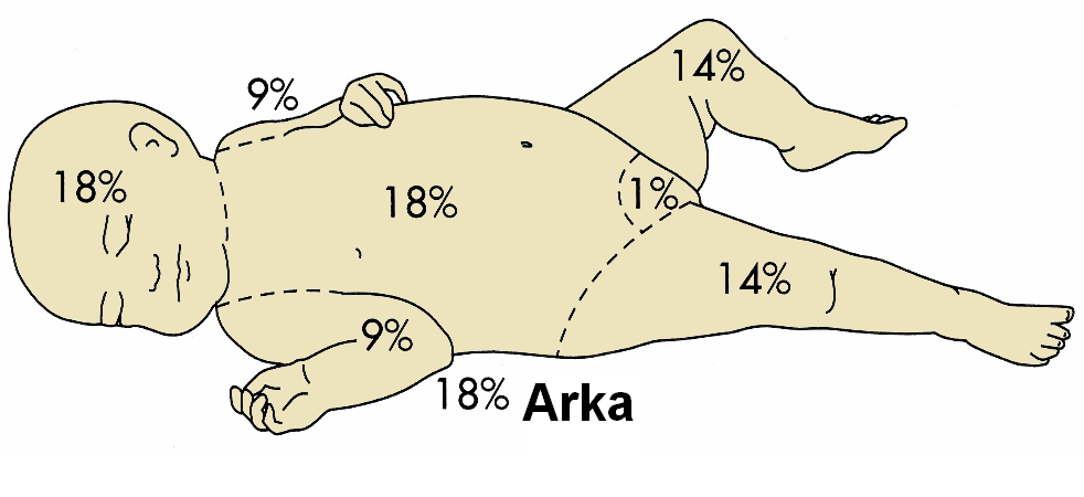 YI okuzlar