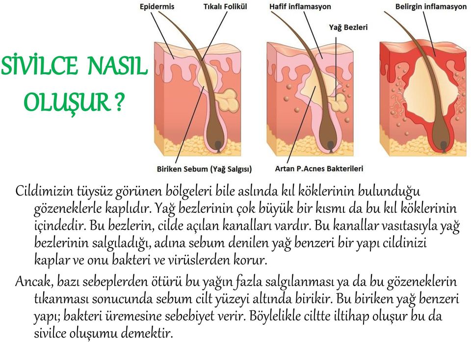 Bu kanallar vasıtasıyla yağ bezlerinin salgıladığı, adına sebum denilen yağ benzeri bir yapı cildinizi kaplar ve onu bakteri ve virüslerden korur.