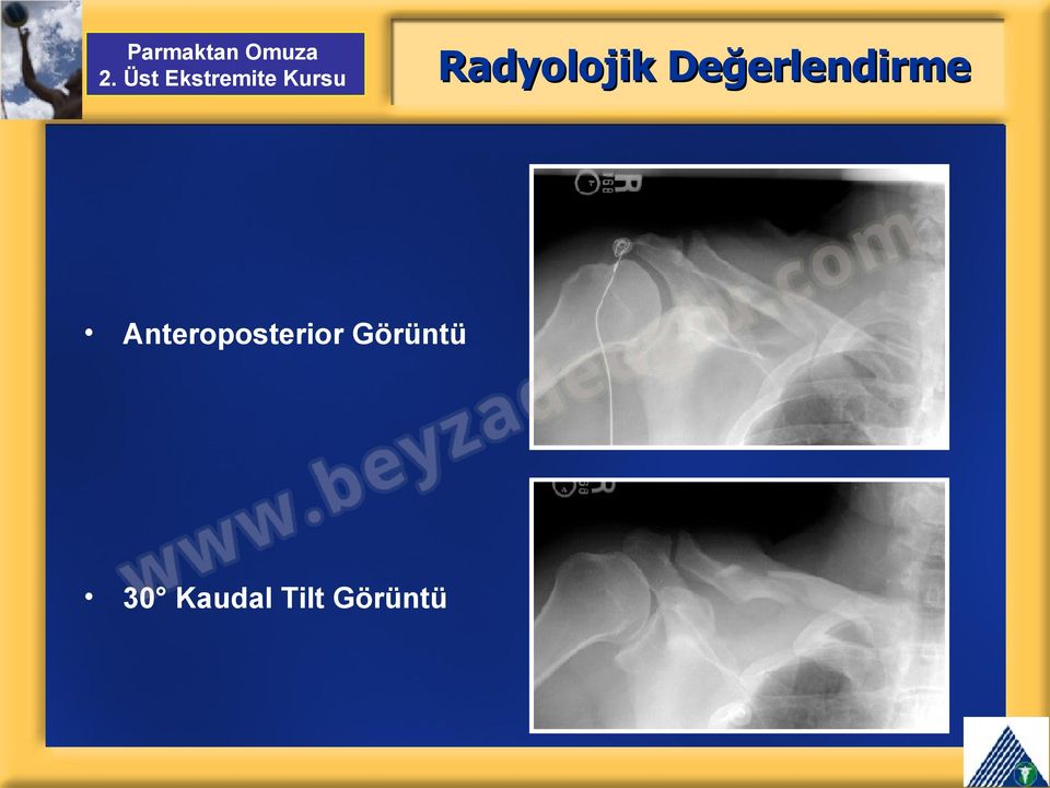 Anteroposterior