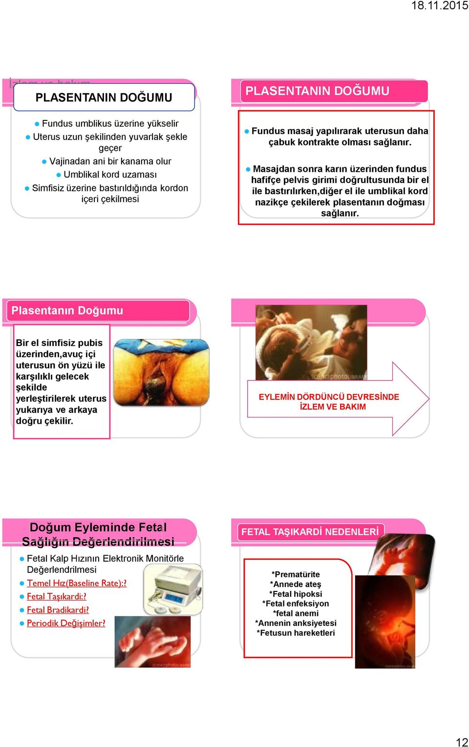 Masajdan sonra karın üzerinden fundus hafifçe pelvis girimi doğrultusunda bir el ile bastırılırken,diğer el ile umblikal kord nazikçe çekilerek plasentanın doğması sağlanır.