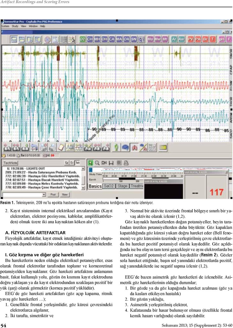 Kayıt sisteminin internal elektriksel arızalarından (Kayıt elektrotları, elektrot pozisyonu, kablolar, amplifikatörlerden) olmak üzere iki ana kaynaktan köken alır (1). A.