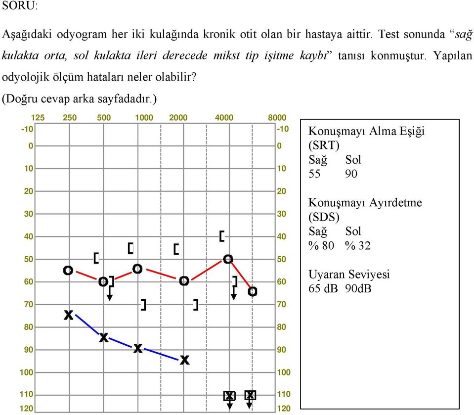 Yapılan odyolojik ölçüm hataları neler olabilir? (Doğru cevap arka sayfadadır.