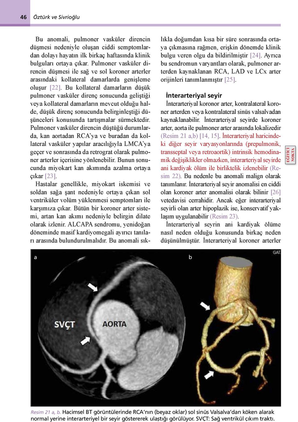 Bu kollateral damarların düşük pulmoner vasküler direnç sonucunda geliştiği veya kollateral damarların mevcut olduğu halde, düşük direnç sonucunda belirginleştiği düşünceleri konusunda tartışmalar