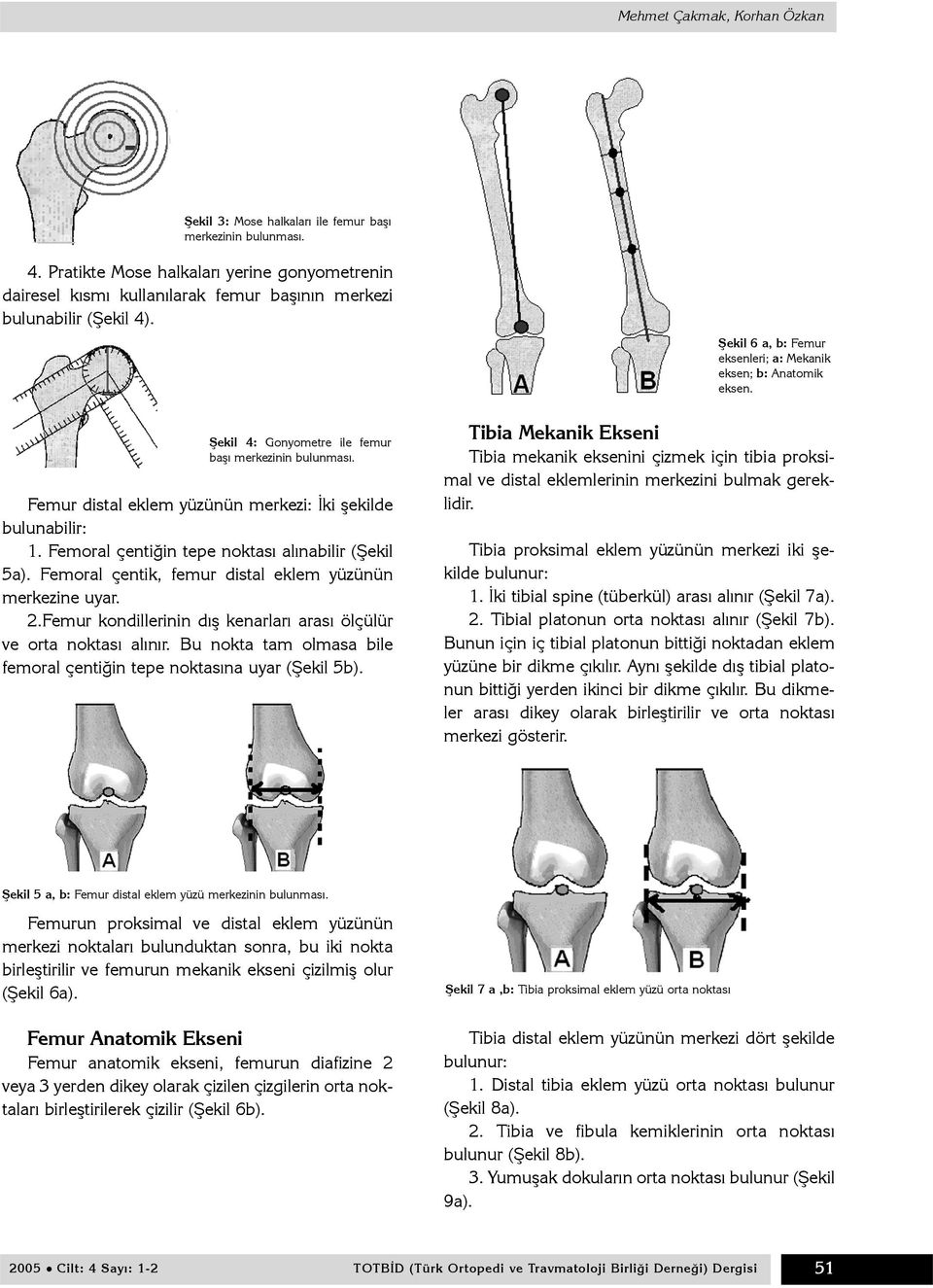 Femur distal eklem yüzünün merkezi: Ýki þekilde bulunabilir: 1. Femoral çentiðin tepe noktasý alýnabilir (Þekil 5a). Femoral çentik, femur distal eklem yüzünün merkezine uyar. 2.