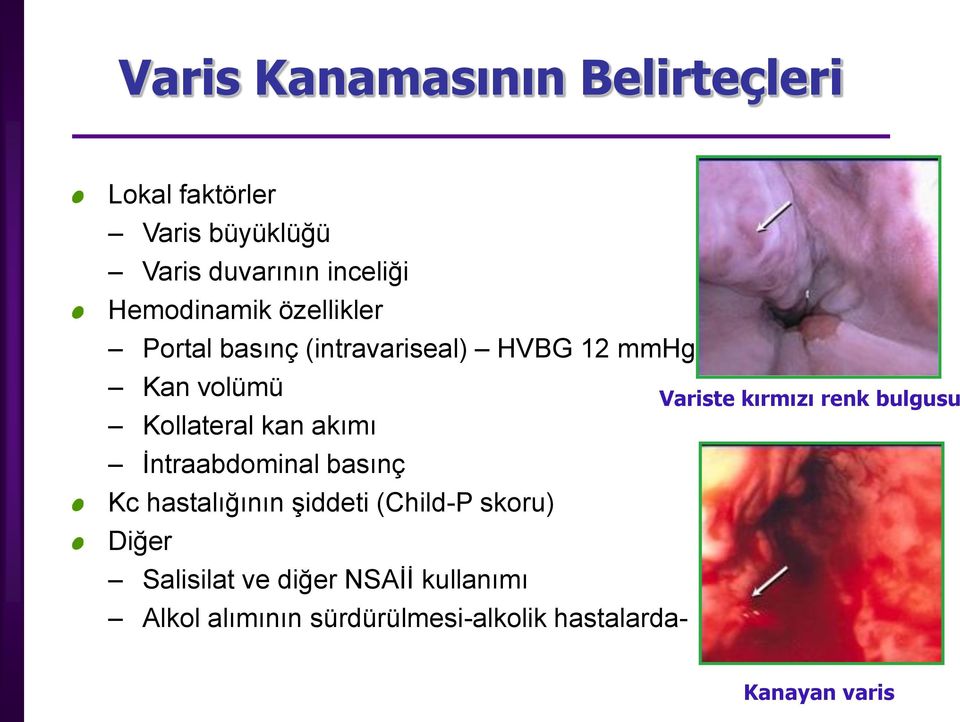 akımı İntraabdominal basınç Kc hastalığının şiddeti (Child-P skoru) Diğer Salisilat ve diğer