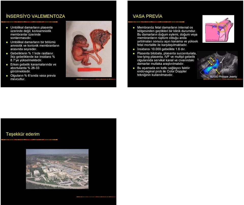 Erken gebelik kanamalarında ve abortularda % 26-33 görülmektedir. Olguların % 6 sında vasa previa mevcuttur. Membranöz fetal damarların internal os bölgesinden geçtikleri bir klinik durumdur.