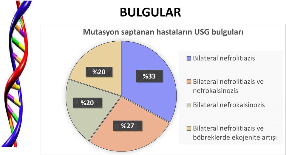 nefrolitiazis ve nefrokalsinozis Bilateral