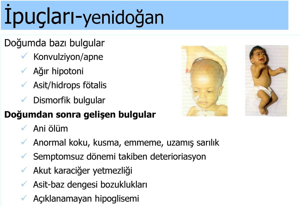 ölüm Anormal koku, kusma, emmeme, uzamış sarılık Semptomsuz dönemi takiben