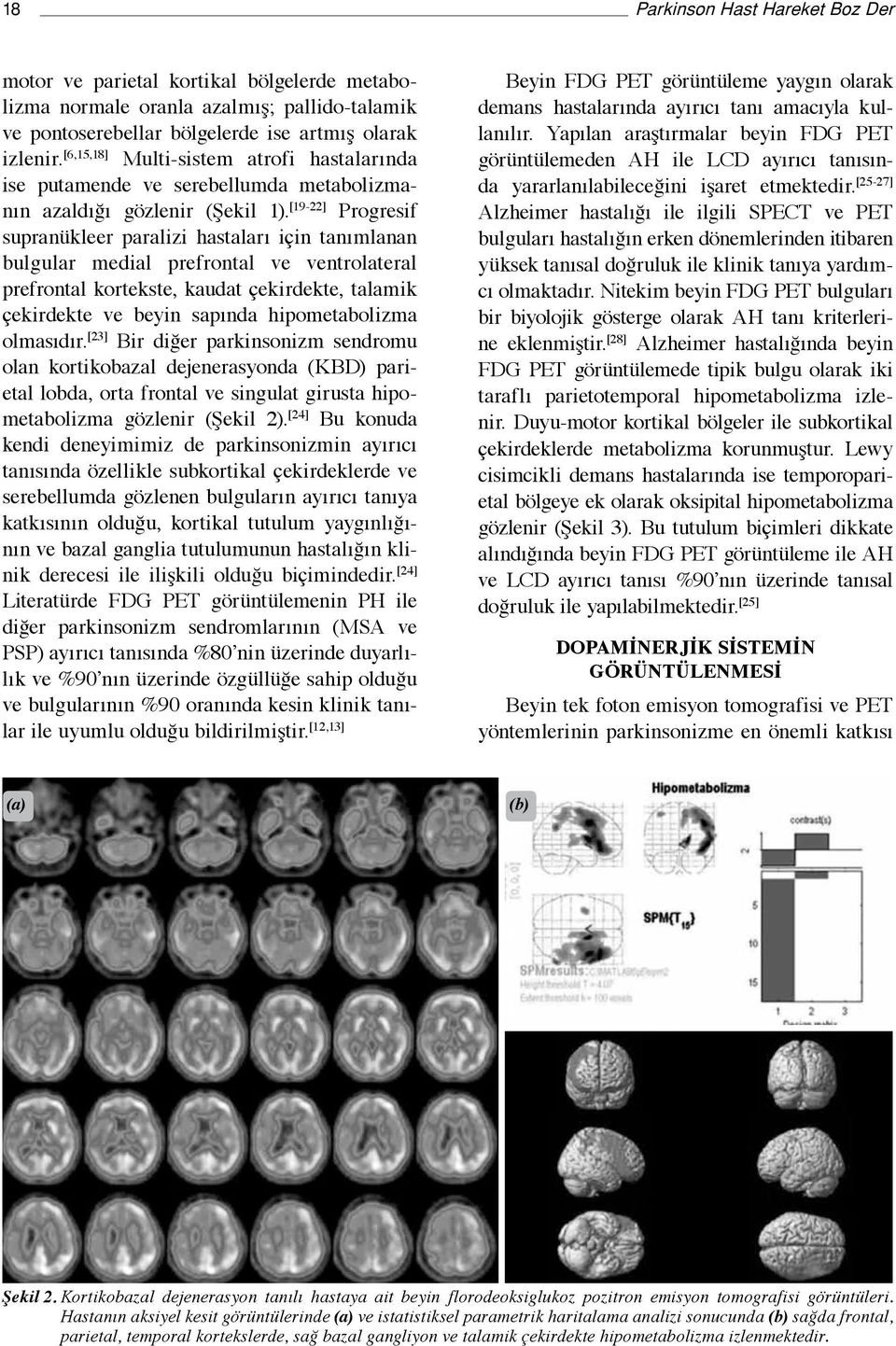 [19-22] Progresif supranükleer paralizi hastaları için tanımlanan bulgular medial prefrontal ve ventrolateral prefrontal kortekste, kaudat çekirdekte, talamik çekirdekte ve beyin sapında