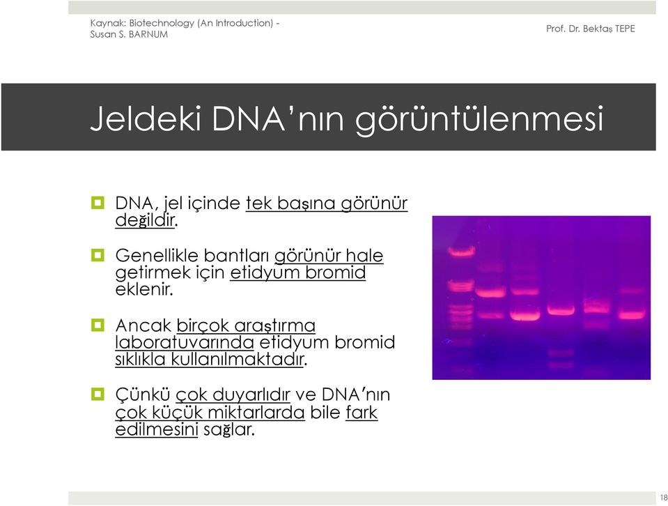 Ancak birçok araştırma laboratuvarında etidyum bromid sıklıkla