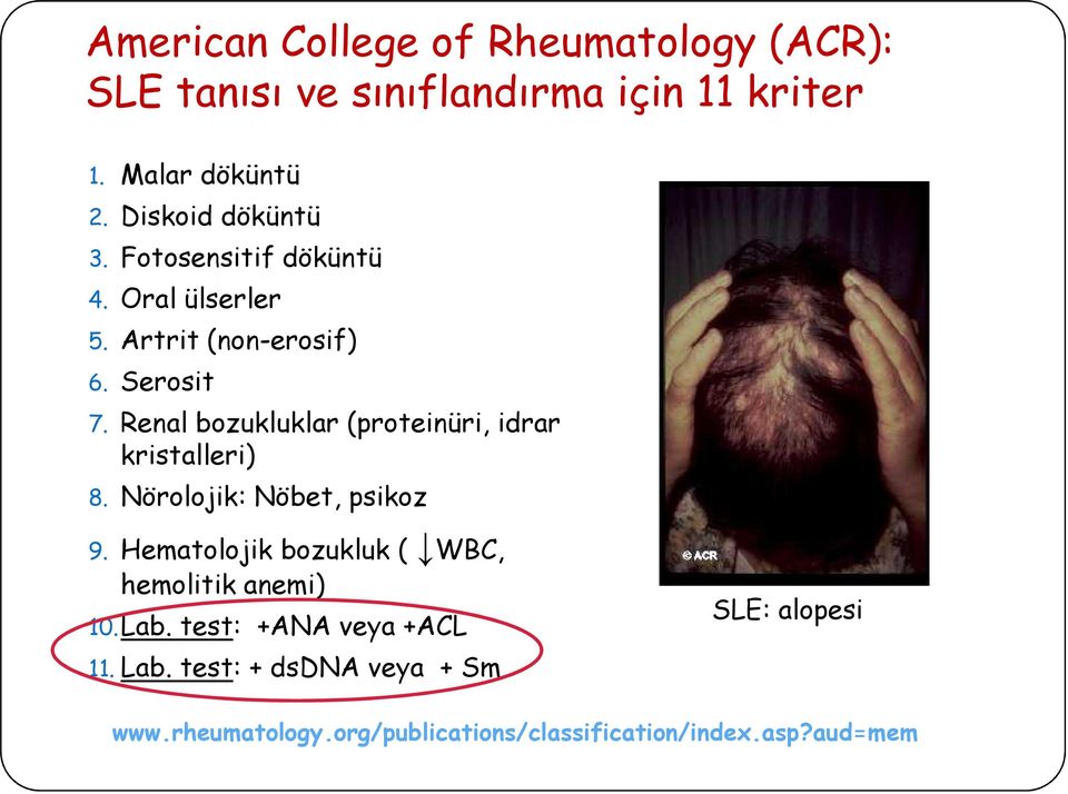 Renal bozukluklar (proteinüri, idrar kristalleri) 8. Nörolojik: Nöbet, psikoz 9.