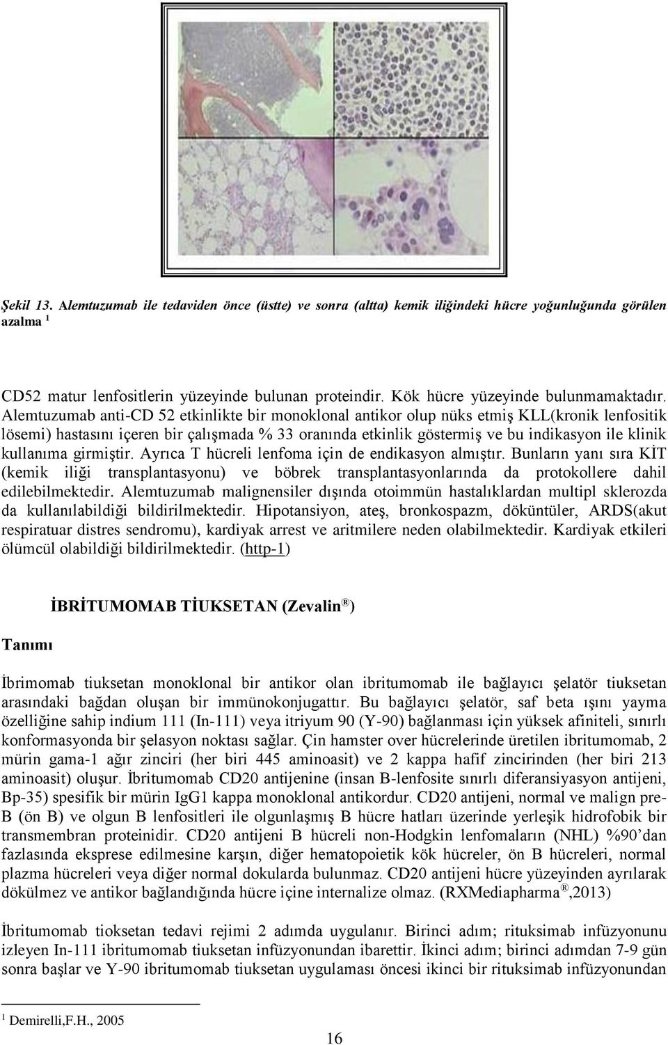 Alemtuzumab anti-cd 52 etkinlikte bir monoklonal antikor olup nüks etmiş KLL(kronik lenfositik lösemi) hastasını içeren bir çalışmada % 33 oranında etkinlik göstermiş ve bu indikasyon ile klinik