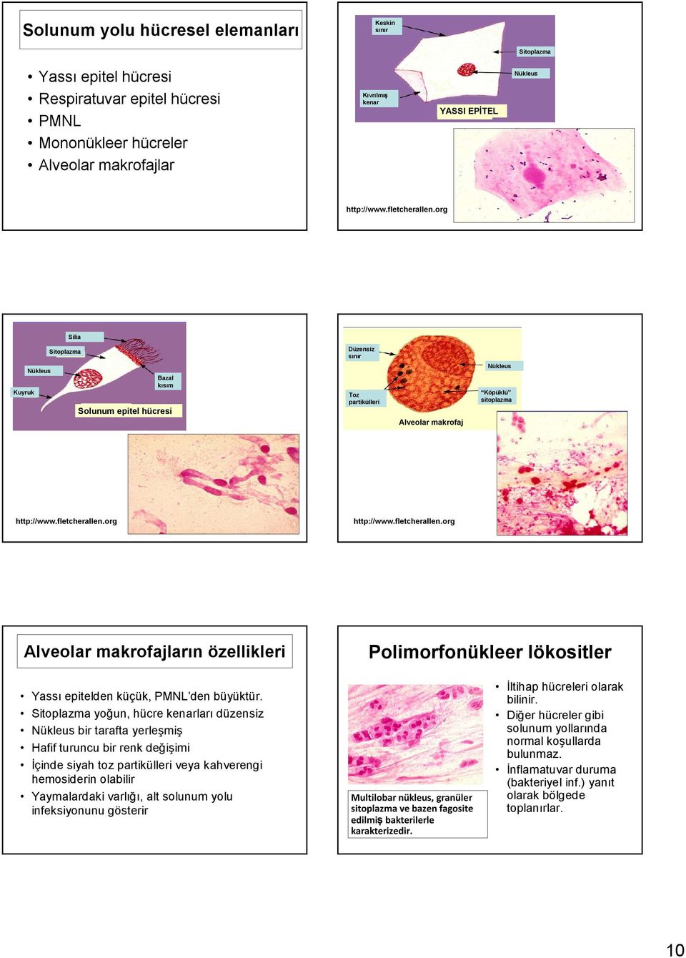 fletcherallen.org Alveolar makrofajların özellikleri Polimorfonükleer lökositler Yassı epitelden küçük, PMNL den büyüktür.