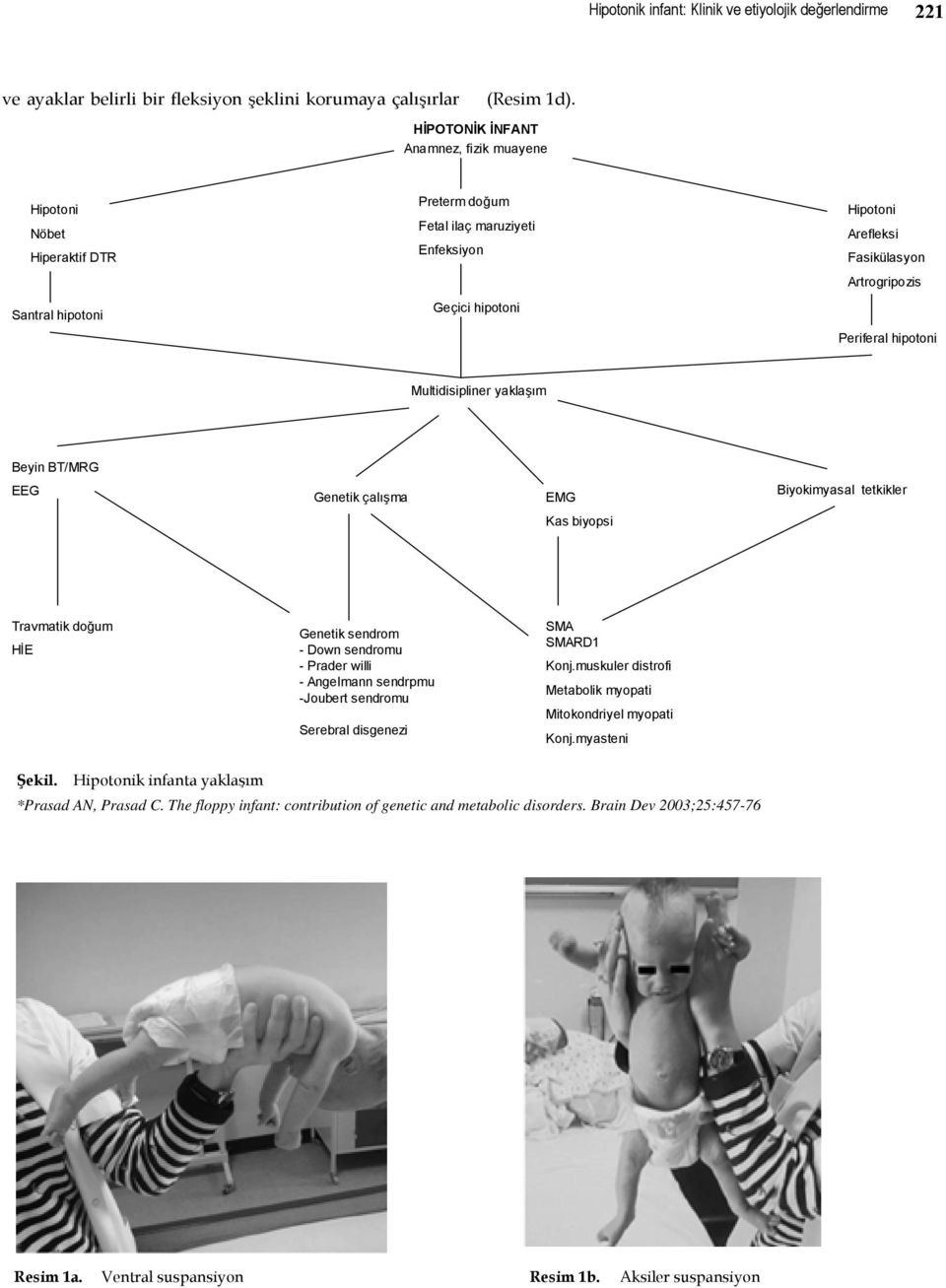 Periferal hipotoni Multidisipliner yaklaşım Beyin BT/MRG EEG Genetik çalışma EMG Biyokimyasal tetkikler Kas biyopsi Travmatik doğum HİE Genetik sendrom - Down sendromu -Praderwilli - Angelmann
