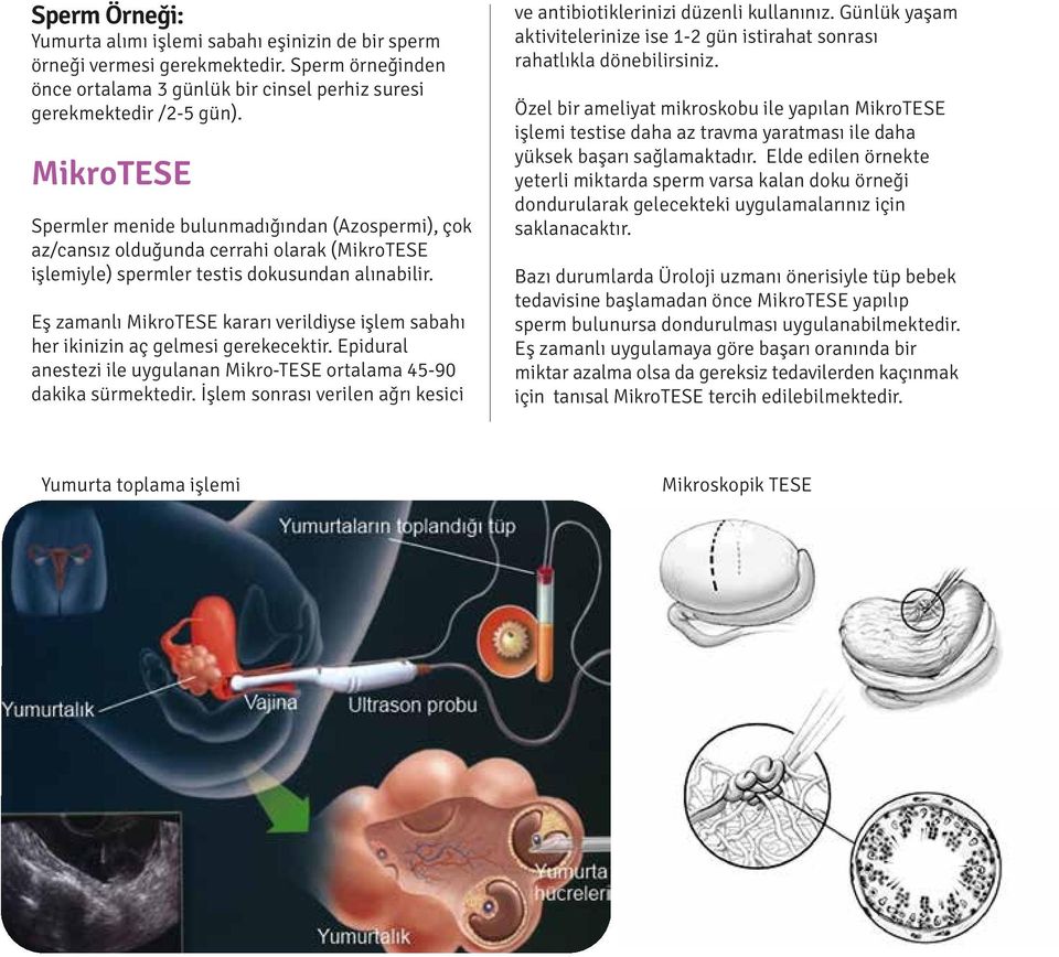 Eş zamanlı MikroTESE kararı verildiyse işlem sabahı her ikinizin aç gelmesi gerekecektir. Epidural anestezi ile uygulanan Mikro-TESE ortalama 45-90 dakika sürmektedir.