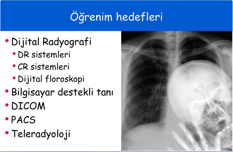 Bilgisayar destekli tanı DICOM