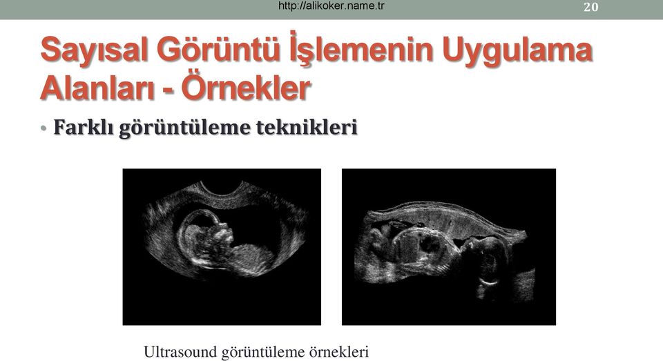 Farklı görüntüleme teknikleri