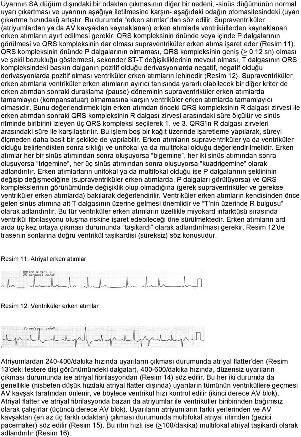 Supraventriküler (atriyumlardan ya da AV kavşaktan kaynaklanan) erken atımlarla ventriküllerden kaynaklanan erken atımların ayırt edilmesi gerekir.