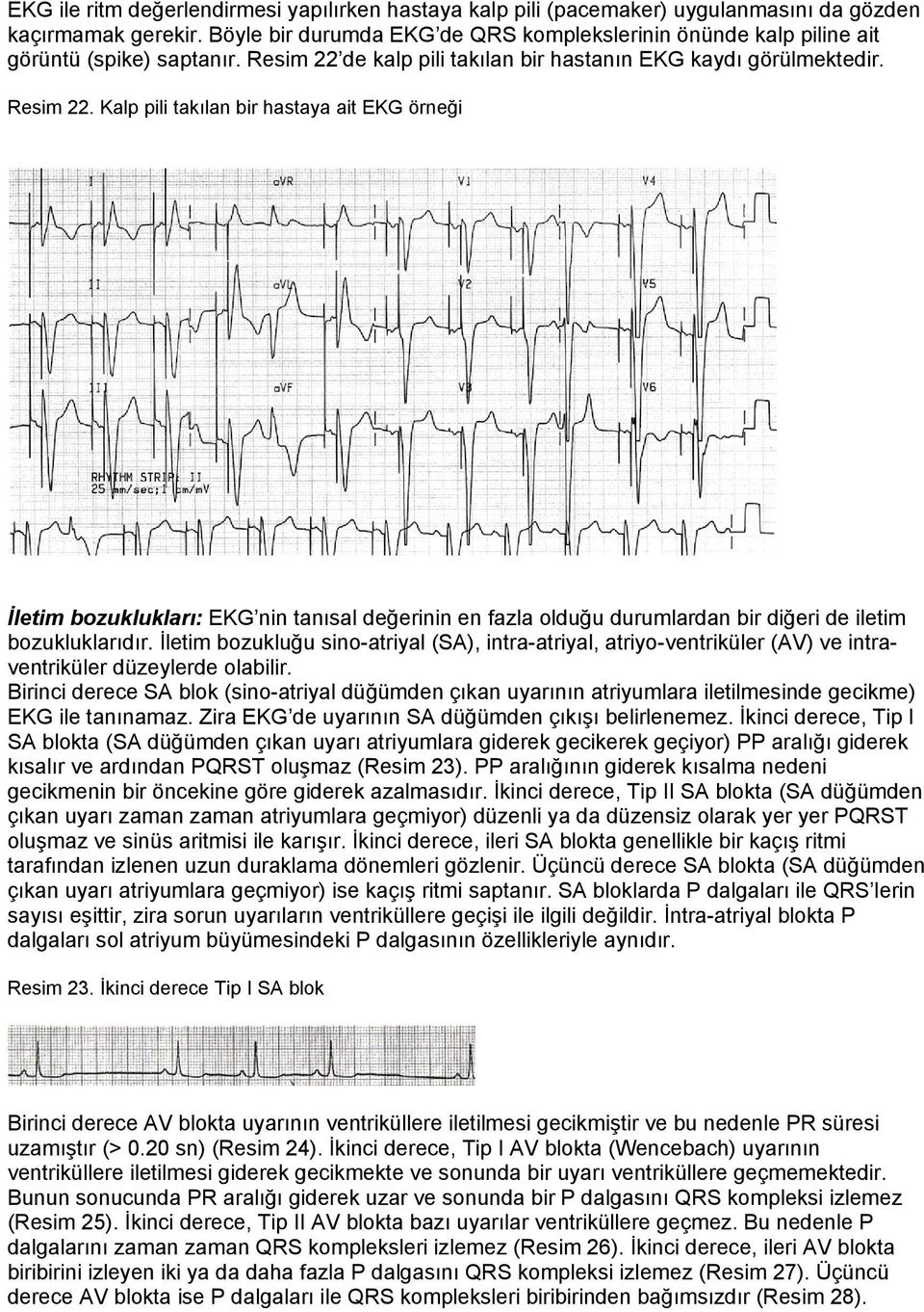 de kalp pili takılan bir hastanın EKG kaydı görülmektedir. Resim 22.