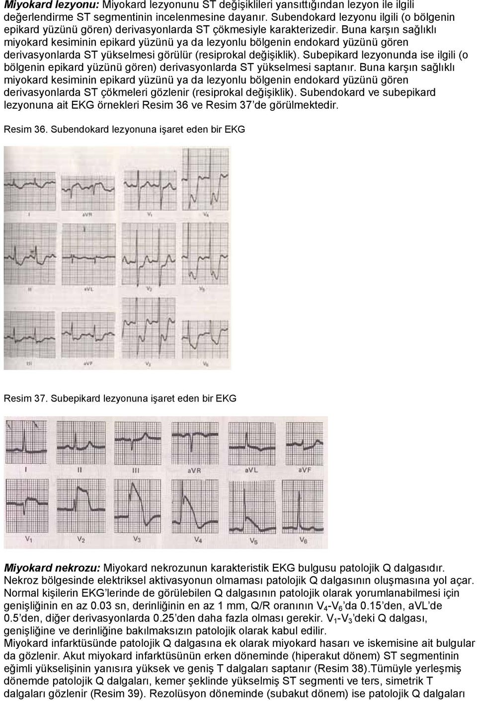 Buna karşın sağlıklı miyokard kesiminin epikard yüzünü ya da lezyonlu bölgenin endokard yüzünü gören derivasyonlarda ST yükselmesi görülür (resiprokal değişiklik).