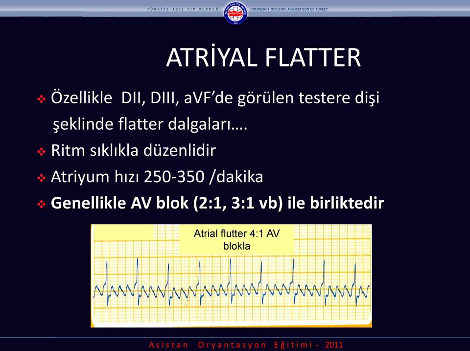 Ritm sıklıkla düzenlidir Atriyum hızı 250-350 /dakika