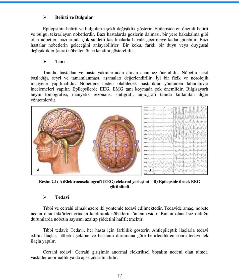 Bir koku, farklı bir duyu veya duygusal değişiklikler (aura) nöbetten önce kendini gösterebilir. Tanı Tanıda, hastadan ve hasta yakınlarından alınan anamnez önemlidir.