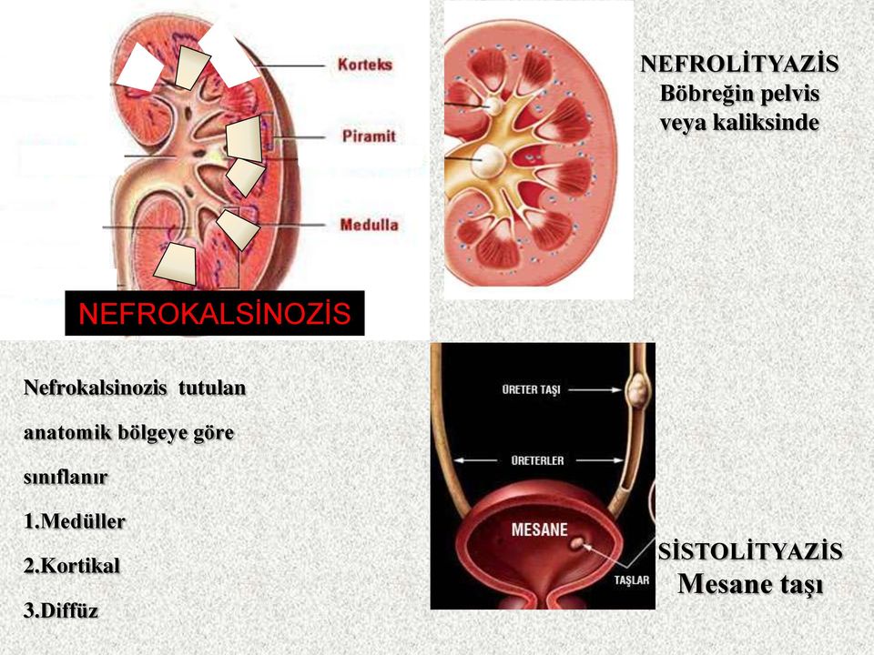 tutulan anatomik bölgeye göre sınıflanır 1.